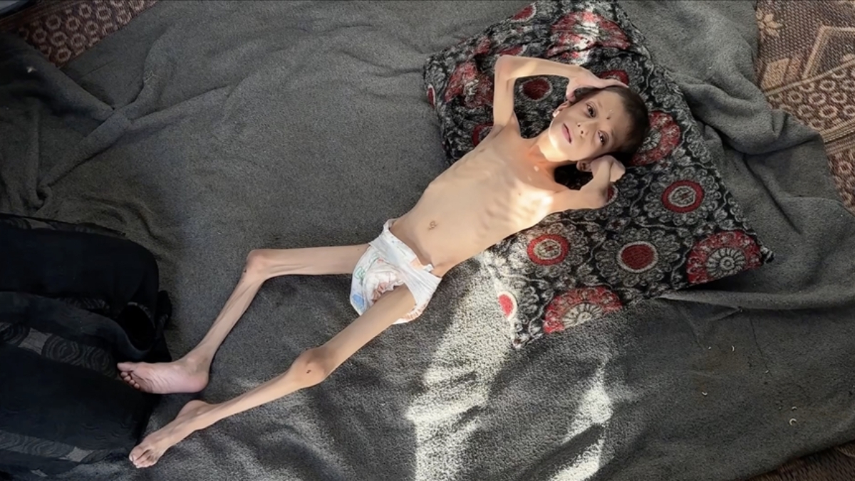 israilin kitliga surukledigi 10 yasindaki nafiz kemik yiginina donustu YfwTRshJ